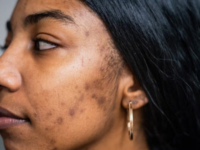 Darkspots