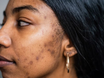 Darkspots