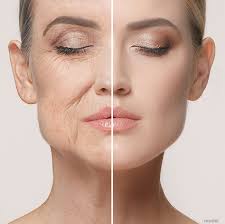 Anti-Aging