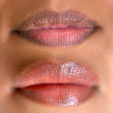 Lip Treatment