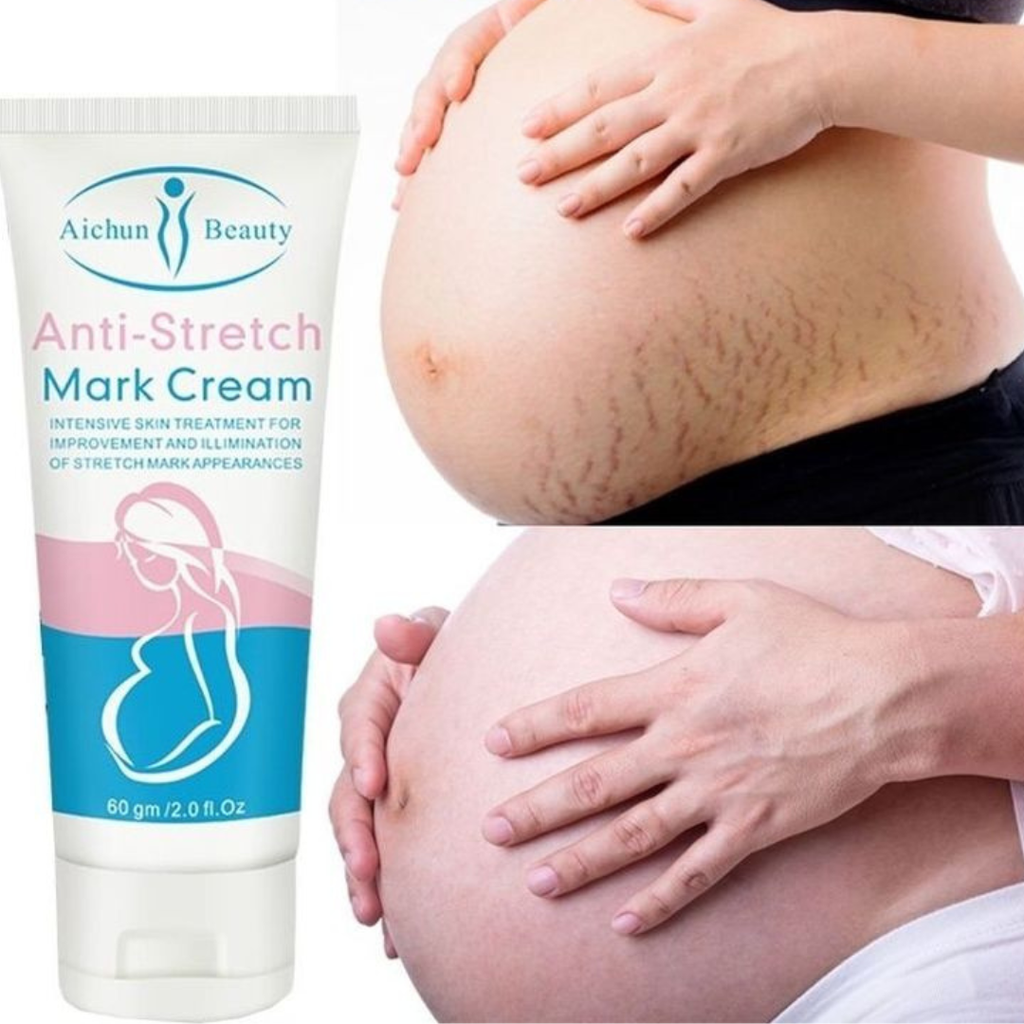 Anti Stretch Mark Cream