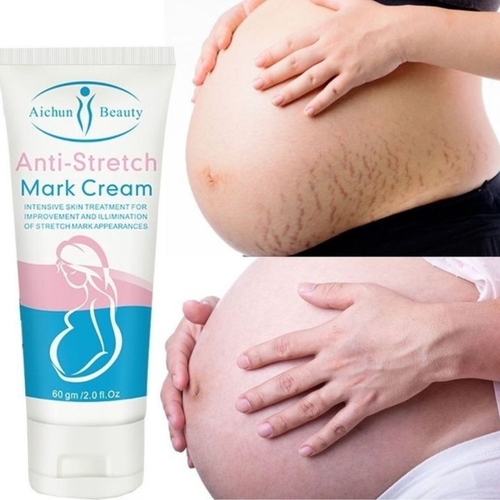 Anti Stretch Mark Cream