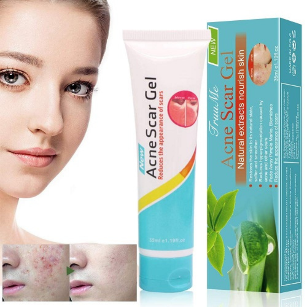 Acne Scar Gel