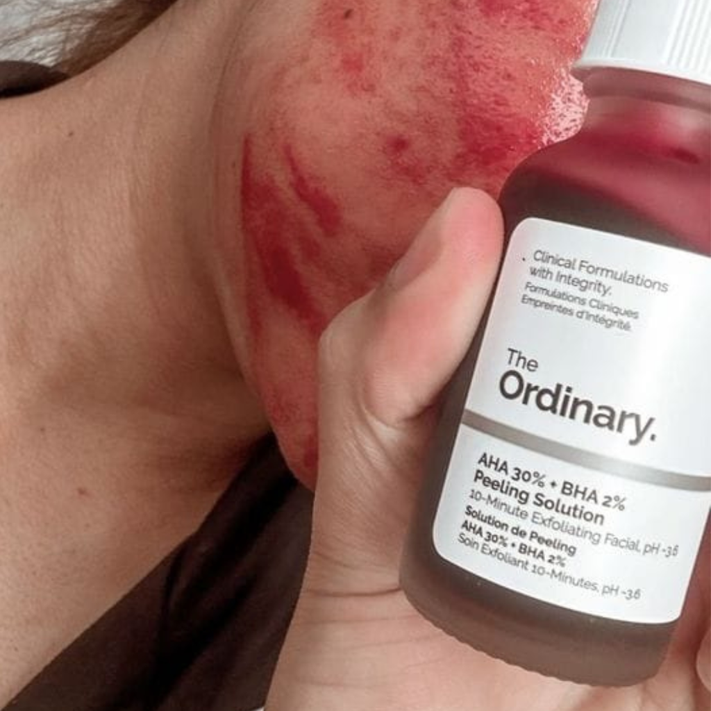 The Ordinary AHA 30% + BHA 2% Peeling Solution