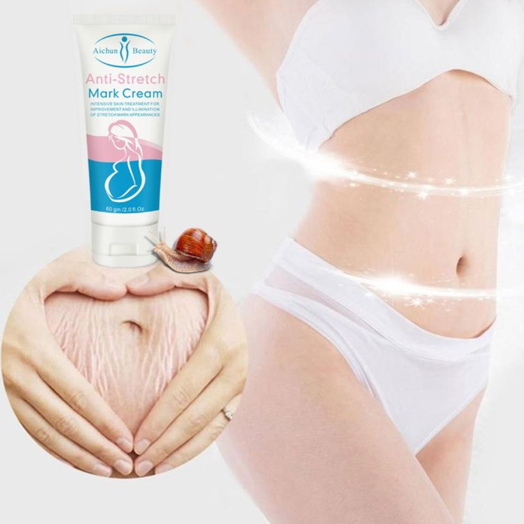 Anti Stretch Mark Cream