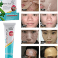 Acne Scar Gel - Cosmera.store