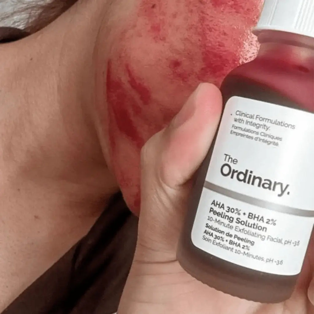 The Ordinary AHA 30% + BHA 2% Peeling Solution